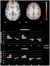 The Neural Correlates of Re...