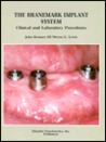 The Branemark Implant System: Clinical And Laboratory Procedures