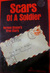 Scars Of A Soldier: Vernon ...