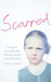 Scarred: How One Girl Triumphed Over Shocking Abuse and Self-Harm (Hardcover)