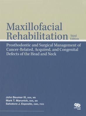 Maxillofacial Rehabilitation: Surgical and Prosthodontic Management of Cancer-Related Acquired, and Congenital Defects of the Head and Neck