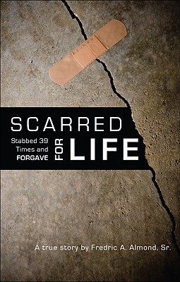 Scarred for Life: Stabbed 39 Times and Forgave