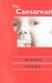 The Caesarean by Michel Odent The Caesarean by Michel Odent