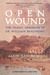 Open Wound by Jason Karlawish Open Wound by Jason Karlawish