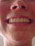 Bartley