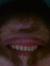 Ruy