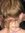 Carie
