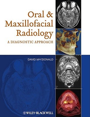 Oral Maxillofacial Radiology: A Diagnostic Approach David MacDonald Oral Maxillofacial Radiology: A Diagnostic Approach David MacDonald