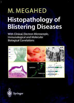 Histopathology Of Blistering Diseases: With Clinical, Electron Microscopic, Immunological And Molecular Biological Correlations Mosaad Megahed Histopathology Of Blistering Diseases: With Clinical, Electron Microscopic, Immunological And Molecular Biological Correlations Mosaad Megahed
