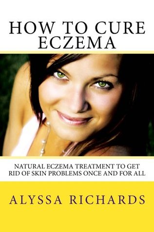How To Cure Eczema - Natural Eczema Treatment To Get Rid Of Skin Problems Once And For All Alyssa Richards How To Cure Eczema - Natural Eczema Treatment To Get Rid Of Skin Problems Once And For All Alyssa Richards