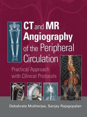 CT and MR Angiography of the Peripheral Circulation: Practical Approach with Clinical Protocols Debabrata Mukherjee CT and MR Angiography of the Peripheral Circulation: Practical Approach with Clinical Protocols Debabrata Mukherjee
